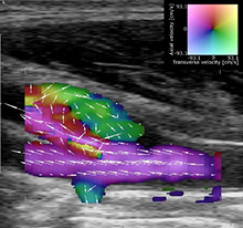 ultra sound flow